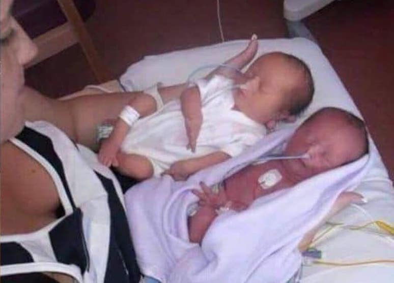 Couple welcomed their babies, ‘then the doctor uttered two words that tipped their world upside down’!