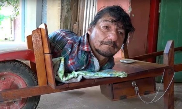 He Had No Arms, No Legs, And 2 Daughters To Raise