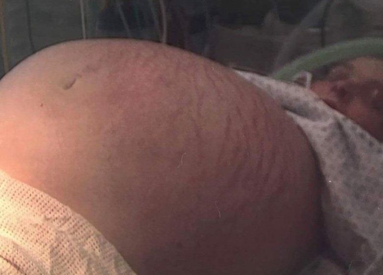 Woman carrying the weight of 7 babies in her huge belly, ‘but doctors had frightening news’!