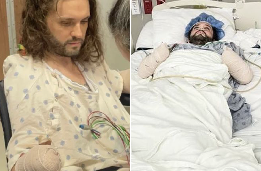 Man was forced to undergo a double amputation, having both his arms and parts of his feet severed following a simple bite!